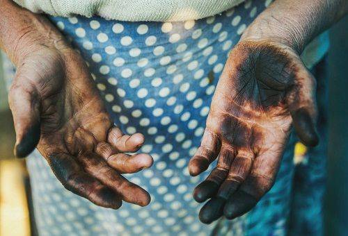 taches de noix sur les mains