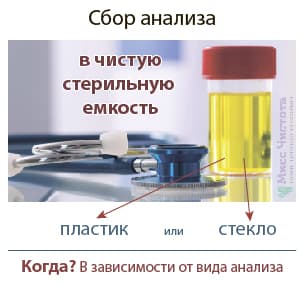 Collecte d'analyses d'urine