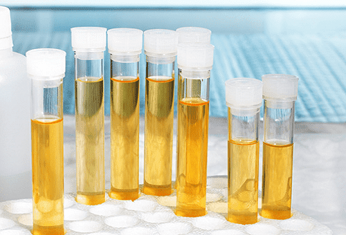 tubes à essai de laboratoire avec de l'urine