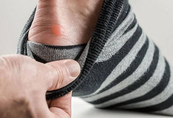 Callosités au talon