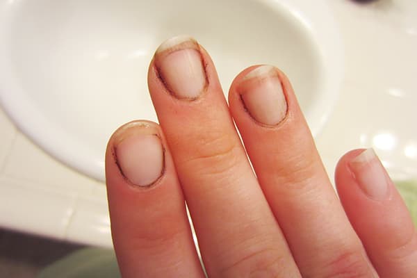 Saleté sous les ongles