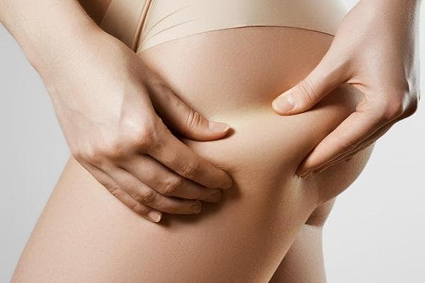 Peau lisse sur les cuisses