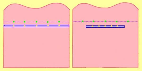 Marquage de l'élastique et du tissu pour une répartition homogène des plis